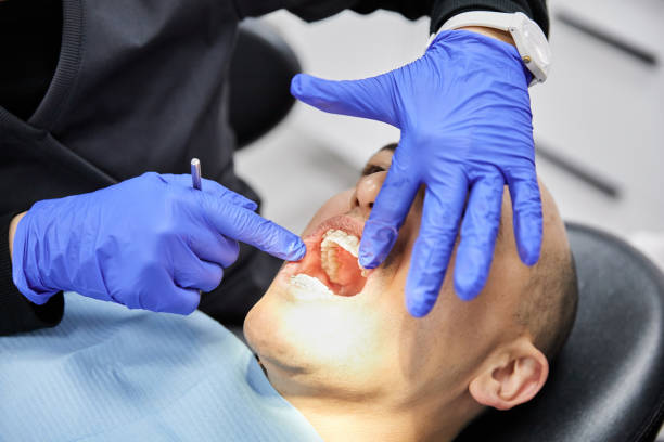 Best Emergency Tooth Extraction in The Homesteads, TX